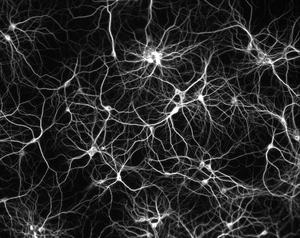 Les réseaux sont à l'image de notre cerveau : un tissu de neurones. Comme le rappelle Jean-Pierre Quignaux : \"il n\'y a pas de neurone-chef\". Le modèle centraliste aussi appelé \"paradigme de la pyramide\" est le modèle du passé. Le réseau est le modèle