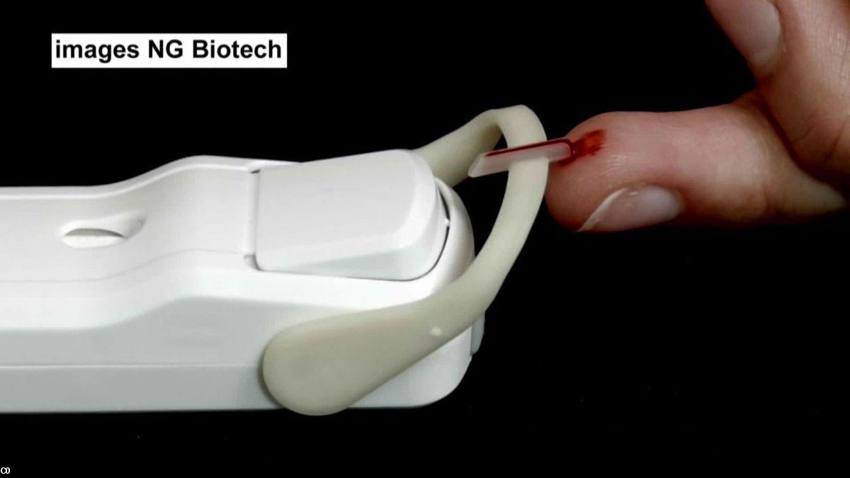 La société bretonne basée à Guipry (35) NG biotech a inventé un test ultra-rapide et bon marché (15 euros). La région passera une commande pour plus de 70 000 tests.